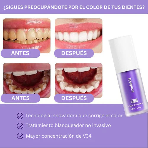 Blanqueador Dental V34™ - HISMILE® (2024) ⭐⭐⭐⭐⭐ PAGAMENTO CONTRA ENTREGA - ENVÍO GRATIS